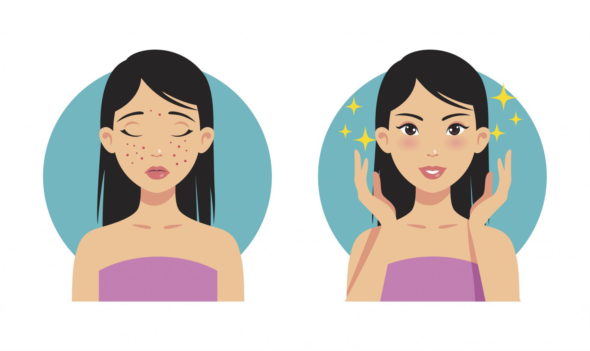 How to get rid of pimples fast All About Acne